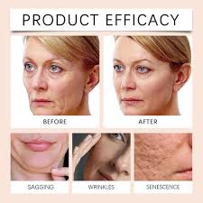 HOUKEA - Bee Venom Skin Care Cream|Skin Tightening Therapy  Radiant & Smooth Skin |Youthful Glow Treatment  in Rebirth Formula