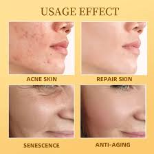 HOUKEA - Bee Venom Skin Care Cream|Skin Tightening Therapy  Radiant & Smooth Skin |Youthful Glow Treatment  in Rebirth Formula