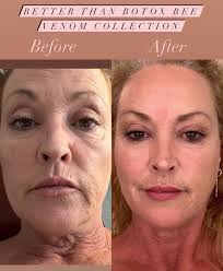 HOUKEA - Bee Venom Skin Care Cream|Skin Tightening Therapy  Radiant & Smooth Skin |Youthful Glow Treatment  in Rebirth Formula